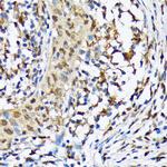 CaMKIV Antibody in Immunohistochemistry (Paraffin) (IHC (P))