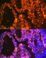 LIN28A Antibody in Immunohistochemistry (Paraffin) (IHC (P))