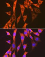 EEF2 Antibody in Immunocytochemistry (ICC/IF)