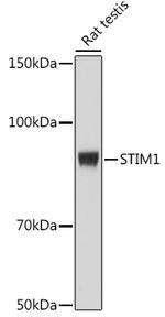 STIM1 Antibody in Western Blot (WB)