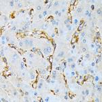 IQGAP1 Antibody in Immunohistochemistry (Paraffin) (IHC (P))