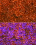 CD3d Antibody in Immunohistochemistry (Paraffin) (IHC (P))