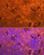 CD3d Antibody in Immunohistochemistry (Paraffin) (IHC (P))