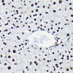 Phospho-Rb (Ser780) Antibody in Immunohistochemistry (Paraffin) (IHC (P))