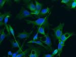 Doublecortin Antibody in Immunocytochemistry (ICC/IF)