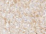 Chordin Antibody in Immunohistochemistry (Paraffin) (IHC (P))