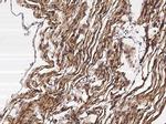 Neuropilin 1 Antibody in Immunohistochemistry (Paraffin) (IHC (P))