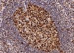 PCNA Antibody in Immunohistochemistry (Paraffin) (IHC (P))