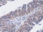 UCP2 Antibody in Immunohistochemistry (Paraffin) (IHC (P))