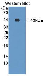 SFTPD Antibody in Western Blot (WB)