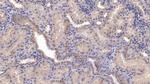 SFRP1 Antibody in Immunohistochemistry (Paraffin) (IHC (P))