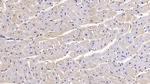 SEMA5B Antibody in Immunohistochemistry (Paraffin) (IHC (P))