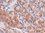 S100A5 Antibody in Immunohistochemistry (Paraffin) (IHC (P))