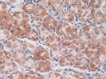 S100A5 Antibody in Immunohistochemistry (Paraffin) (IHC (P))