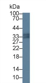 S100A12 Antibody in Western Blot (WB)