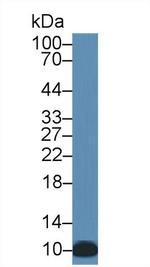 S100A12 Antibody in Western Blot (WB)