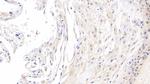 ROS1 Antibody in Immunohistochemistry (Paraffin) (IHC (P))