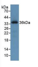 ROS1 Antibody in Western Blot (WB)