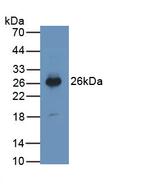 PTGDS Antibody in Western Blot (WB)