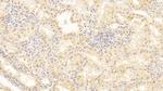 Periostin Antibody in Immunohistochemistry (Paraffin) (IHC (P))