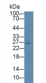 Prolactin Antibody in Western Blot (WB)