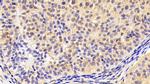 INHA Antibody in Immunohistochemistry (Paraffin) (IHC (P))