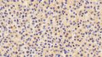 INHA Antibody in Immunohistochemistry (Paraffin) (IHC (P))