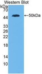 IL-28A Antibody in Western Blot (WB)