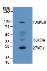 HFE2 Antibody in Western Blot (WB)