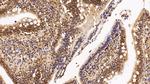 HDAC1 Antibody in Immunohistochemistry (Paraffin) (IHC (P))