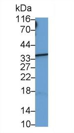 HBB Antibody in Western Blot (WB)