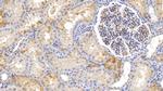 Ferritin Heavy Chain Antibody in Immunohistochemistry (Paraffin) (IHC (P))