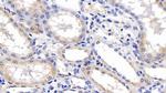 ERLIN2 Antibody in Immunohistochemistry (Paraffin) (IHC (P))