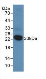 DUSP3 Antibody in Western Blot (WB)