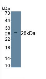 DKK2 Antibody in Western Blot (WB)