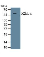 COL5A2 Antibody in Western Blot (WB)