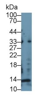 Procollagen I N-Peptide Antibody in Western Blot (WB)