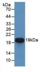 CDNF Antibody in Western Blot (WB)