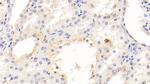 KIM-1 Antibody in Immunohistochemistry (Paraffin) (IHC (P))