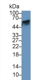 RANK (CD265) Antibody in Western Blot (WB)