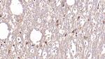 ASPH Antibody in Immunohistochemistry (Paraffin) (IHC (P))