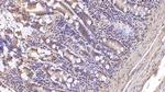 ASPH Antibody in Immunohistochemistry (Paraffin) (IHC (P))