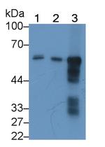 alpha Amylase 1 Antibody in Western Blot (WB)