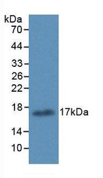 ALOX15 Antibody in Western Blot (WB)