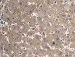 A1BG Antibody in Immunohistochemistry (Paraffin) (IHC (P))