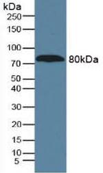 A1BG Antibody in Western Blot (WB)