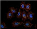 Csk Antibody in Immunocytochemistry (ICC/IF)