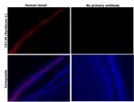 CD138 Antibody in Immunohistochemistry (Paraffin) (IHC (P))