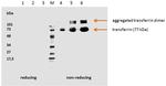 Transferrin Antibody in Western Blot (WB)