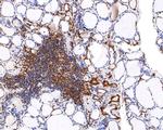 REST Antibody in Immunohistochemistry (Paraffin) (IHC (P))